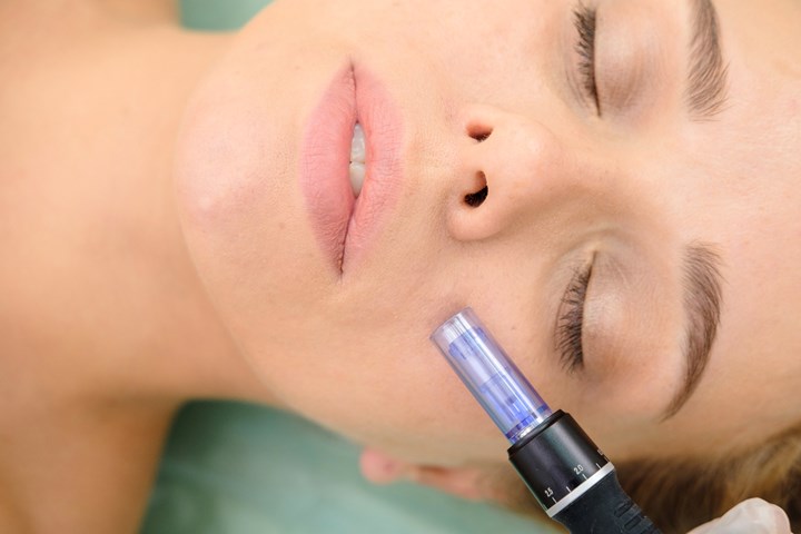 Micro-Needling Haywards Heath