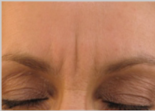 Frown Serum Treatment Environ - Winslow Skincare